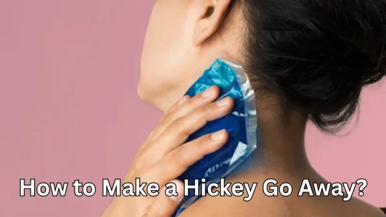 How to Make a Hickey Go Away